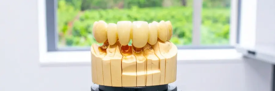 Dental Crowns