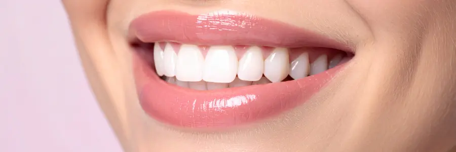 Digital Smile Makeover