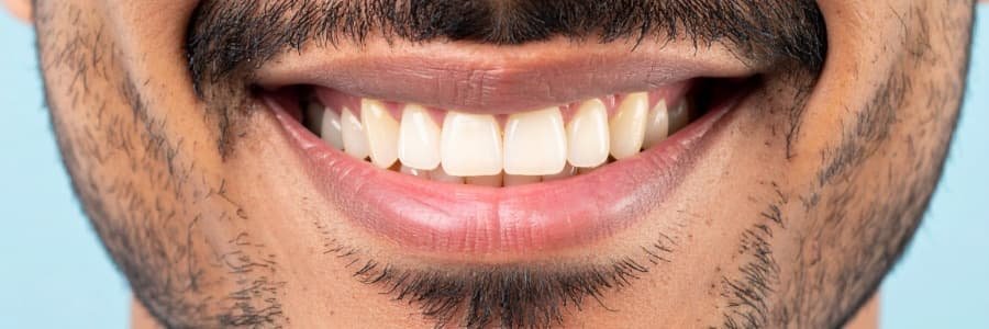 Dr vaibhav nikam why smile makeover is advanced form of cosmetic dentistry